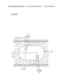 ULTRASOUND MEDICAL APPARATUS AND ULTRASOUND DIAGNOSIS APPARATUS diagram and image