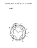 ULTRASOUND MEDICAL APPARATUS AND ULTRASOUND DIAGNOSIS APPARATUS diagram and image