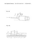 ULTRASOUND MEDICAL APPARATUS AND ULTRASOUND DIAGNOSIS APPARATUS diagram and image