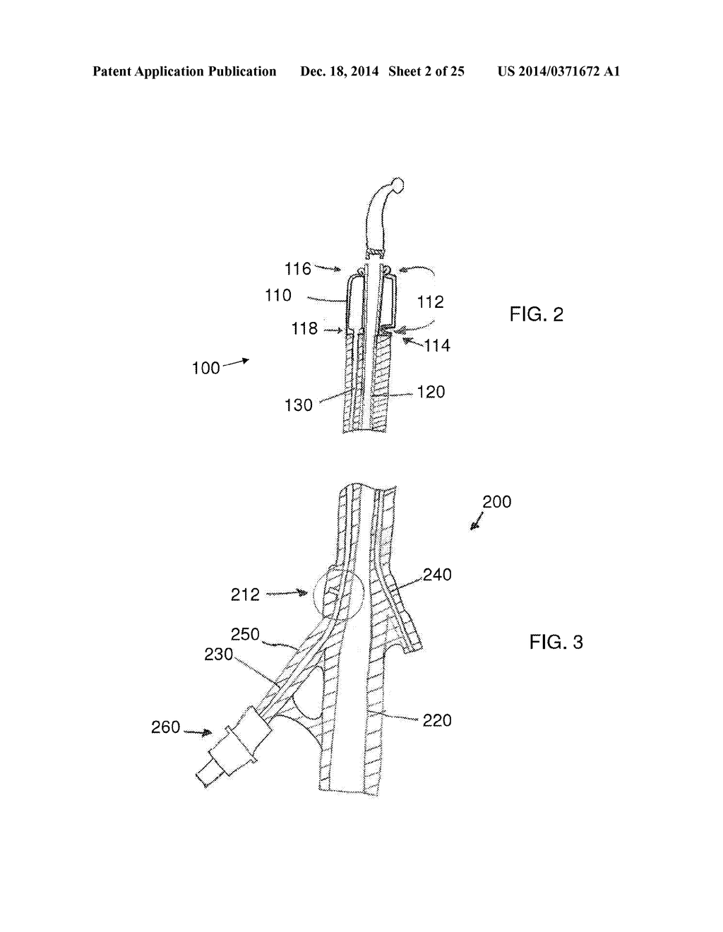 Stretch Valve Balloon Catheter and Methods for Producing and Using Same - diagram, schematic, and image 03