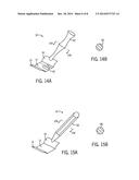 Rapid Access Vitreal Injection Guide diagram and image