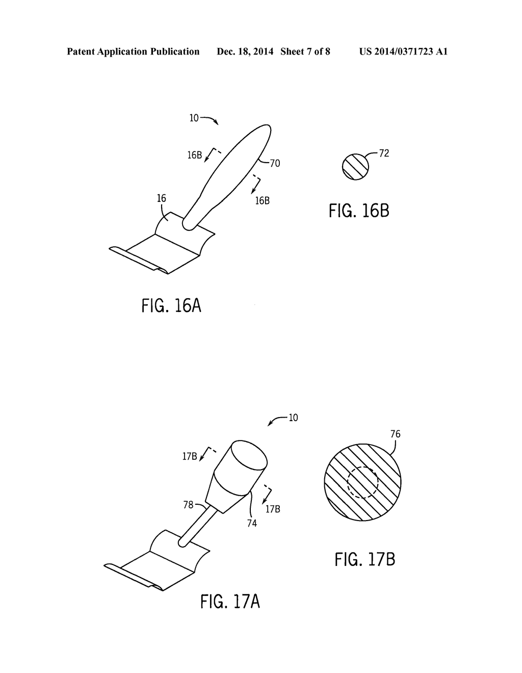 Rapid Access Vitreal Injection Guide - diagram, schematic, and image 08