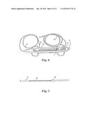 CONTROLLER FOR AN ATHERECTOMY DEVICE diagram and image