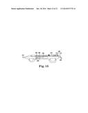 CONTROLLER FOR AN ATHERECTOMY DEVICE diagram and image