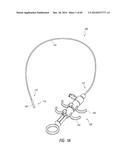 IMPLANTABLE LUMINAL DEVICES diagram and image