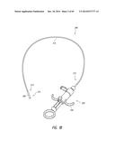 IMPLANTABLE LUMINAL DEVICES diagram and image