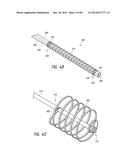 IMPLANTABLE LUMINAL DEVICES diagram and image