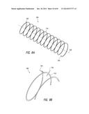 IMPLANTABLE LUMINAL DEVICES diagram and image