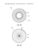 IMPLANTABLE LUMINAL DEVICES diagram and image