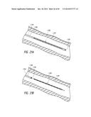 IMPLANTABLE LUMINAL DEVICES diagram and image