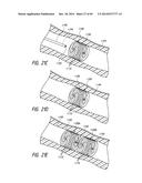 IMPLANTABLE LUMINAL DEVICES diagram and image