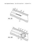 IMPLANTABLE LUMINAL DEVICES diagram and image