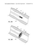 IMPLANTABLE LUMINAL DEVICES diagram and image