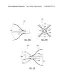 IMPLANTABLE LUMINAL DEVICES diagram and image