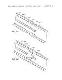 IMPLANTABLE LUMINAL DEVICES diagram and image