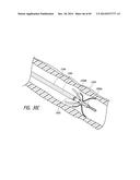 IMPLANTABLE LUMINAL DEVICES diagram and image