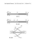 IMPLANTABLE LUMINAL DEVICES diagram and image