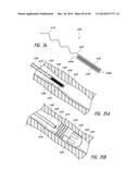 IMPLANTABLE LUMINAL DEVICES diagram and image