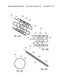 IMPLANTABLE LUMINAL DEVICES diagram and image