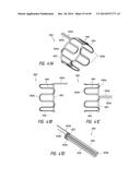 IMPLANTABLE LUMINAL DEVICES diagram and image