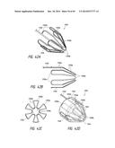 IMPLANTABLE LUMINAL DEVICES diagram and image