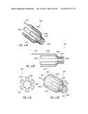 IMPLANTABLE LUMINAL DEVICES diagram and image