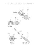 IMPLANTABLE LUMINAL DEVICES diagram and image