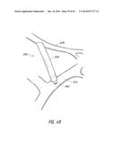 IMPLANTABLE LUMINAL DEVICES diagram and image