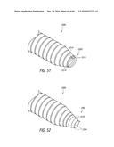 IMPLANTABLE LUMINAL DEVICES diagram and image