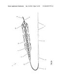 CLOT RETRIEVAL DEVICE FOR REMOVING OCCLUSIVE CLOT FROM A BLOOD VESSEL diagram and image