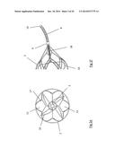 CLOT RETRIEVAL DEVICE FOR REMOVING OCCLUSIVE CLOT FROM A BLOOD VESSEL diagram and image