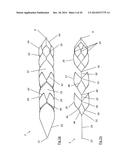 CLOT RETRIEVAL DEVICE FOR REMOVING OCCLUSIVE CLOT FROM A BLOOD VESSEL diagram and image