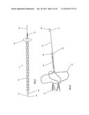 CLOT RETRIEVAL DEVICE FOR REMOVING OCCLUSIVE CLOT FROM A BLOOD VESSEL diagram and image