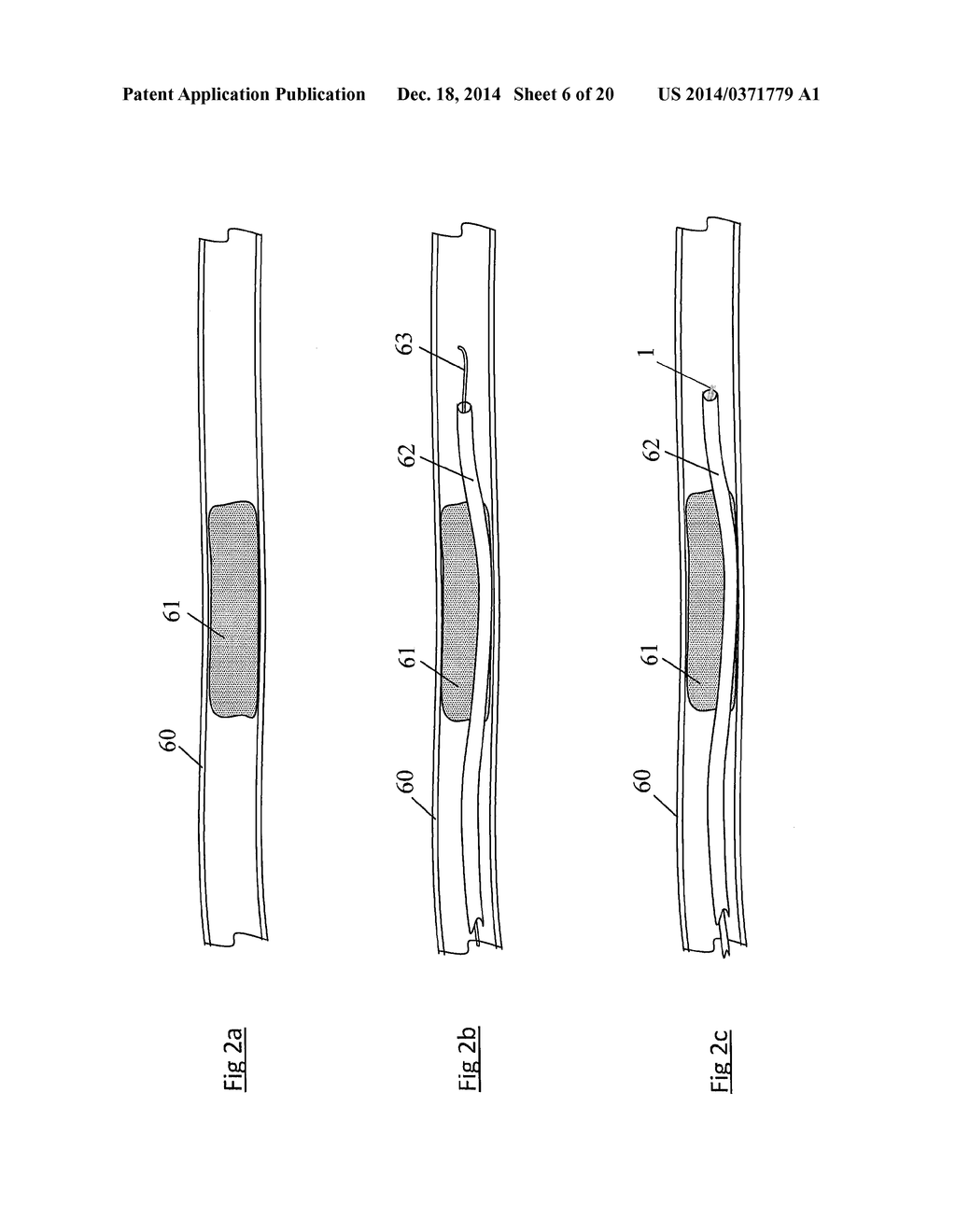 CLOT RETRIEVAL DEVICE FOR REMOVING OCCLUSIVE CLOT FROM A BLOOD VESSEL - diagram, schematic, and image 07