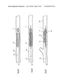 CLOT RETRIEVAL DEVICE FOR REMOVING OCCLUSIVE CLOT FROM A BLOOD VESSEL diagram and image