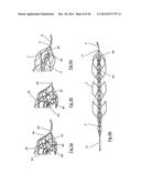 CLOT RETRIEVAL DEVICE FOR REMOVING OCCLUSIVE CLOT FROM A BLOOD VESSEL diagram and image