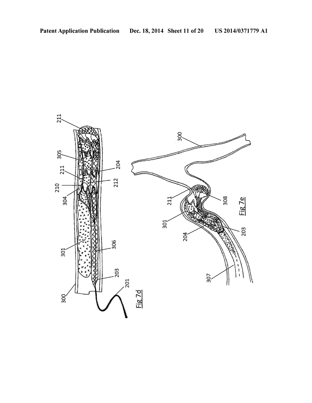 CLOT RETRIEVAL DEVICE FOR REMOVING OCCLUSIVE CLOT FROM A BLOOD VESSEL - diagram, schematic, and image 12