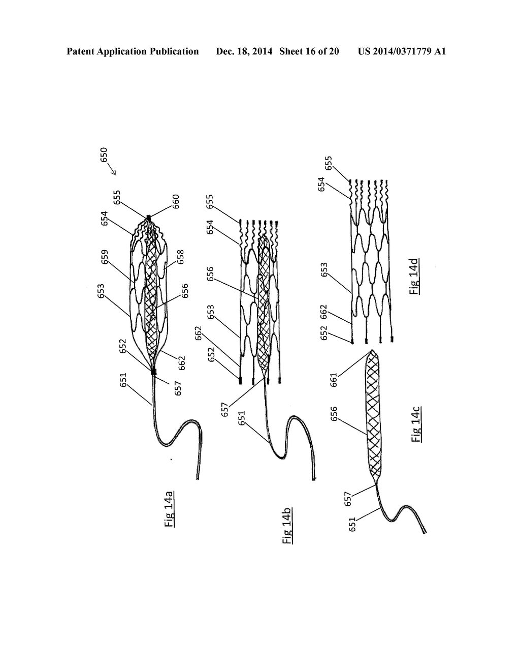 CLOT RETRIEVAL DEVICE FOR REMOVING OCCLUSIVE CLOT FROM A BLOOD VESSEL - diagram, schematic, and image 17