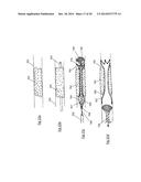CLOT RETRIEVAL DEVICE FOR REMOVING OCCLUSIVE CLOT FROM A BLOOD VESSEL diagram and image
