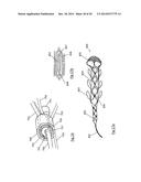 CLOT RETRIEVAL DEVICE FOR REMOVING OCCLUSIVE CLOT FROM A BLOOD VESSEL diagram and image