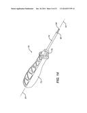 Bone Plate System And Method diagram and image