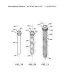 Bone Plate System And Method diagram and image