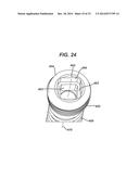 Bone Plate System And Method diagram and image