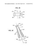 Bone Plate System And Method diagram and image