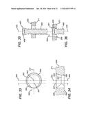 Bone Plate System And Method diagram and image