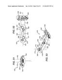 Bone Plate System And Method diagram and image