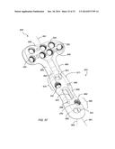 Bone Plate System And Method diagram and image