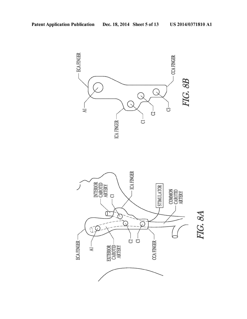 SYSTEM AND METHOD FOR MAPPING BARORECEPTORS - diagram, schematic, and image 06