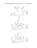 SYSTEM AND METHOD FOR MAPPING BARORECEPTORS diagram and image