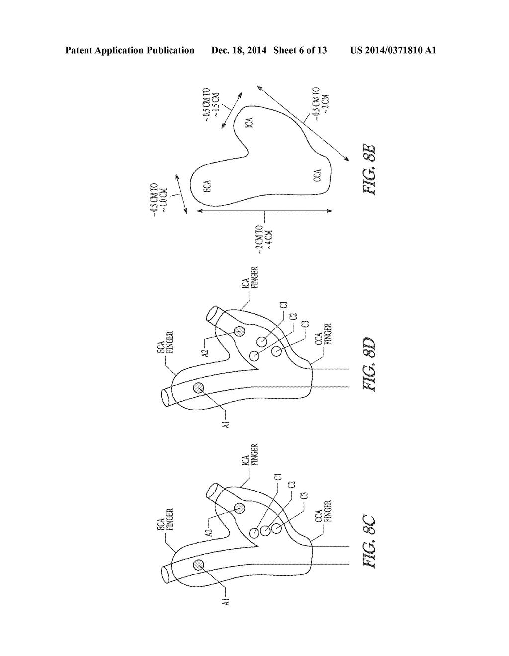 SYSTEM AND METHOD FOR MAPPING BARORECEPTORS - diagram, schematic, and image 07